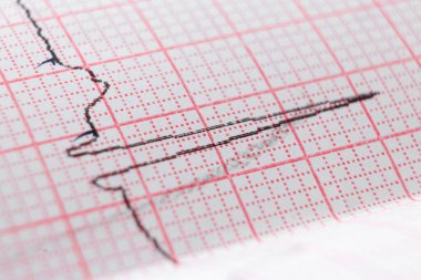 Özel kağıda kalp elektrokardiyogramı EKG grafiği. Kalp taraması, sağlık sigortası, tıbbi geçmiş, muayene