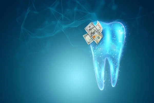 Human Tooth Hologram Dollores Caries Blue Background Concept Expensive Dental — Stock Photo, Image