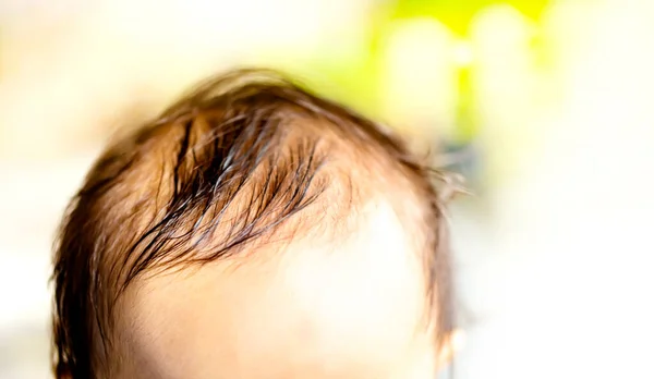 Close Head Forehead Baby Face Copy Space Baby Black Hair — Stock Photo, Image