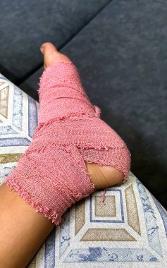 Pembe bir tıbbi bandaja sarılı bir ayağın yakın çekimi, desenli bir yüzeyde dinleniyor..