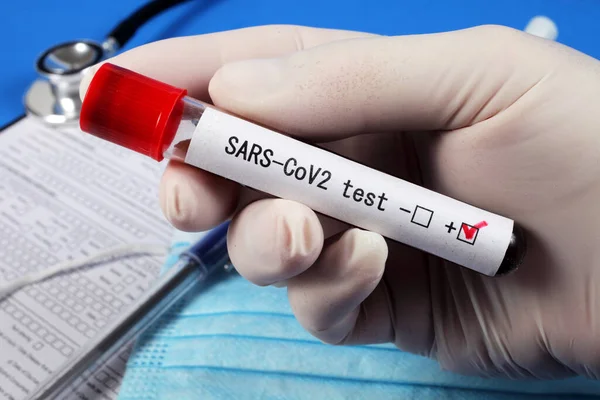 Sars Teste Cov2 Tubo Vácuo Com Sangue Mão Médico Foco — Fotografia de Stock