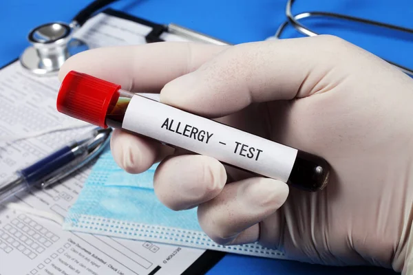 Teste Alergia Tubo Vácuo Com Sangue Mão Médico Foco Seletivo — Fotografia de Stock