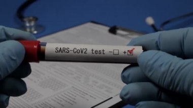Sars - CoV2 testi, vakum tüpü, doktorun elinde kan, seçici odaklanma, yakın çekim.