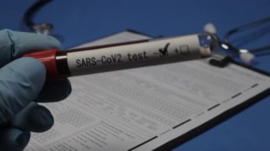 Sars - CoV2 testi, vakum tüpü, doktorun elinde kan, seçici odaklanma, yakın çekim.