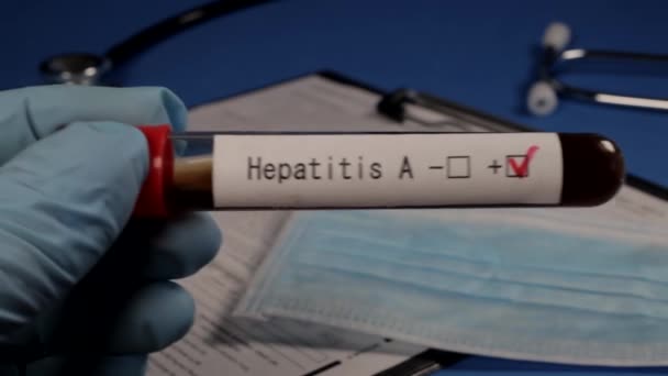 Blodprov För Hepatit Ett Vakuumrör Med Blod — Stockvideo