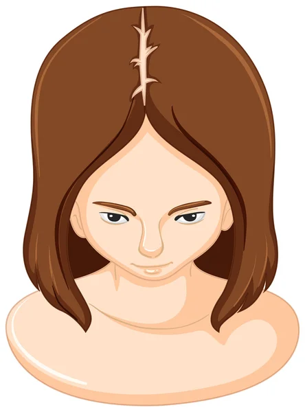 Nő, és a ritkuló haj — Stock Vector