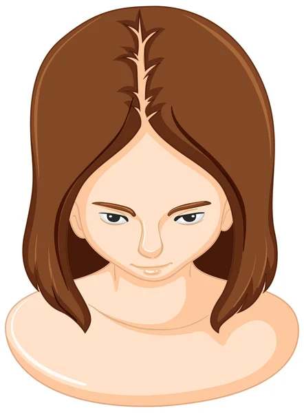 Mujer y pérdida de cabello — Vector de stock