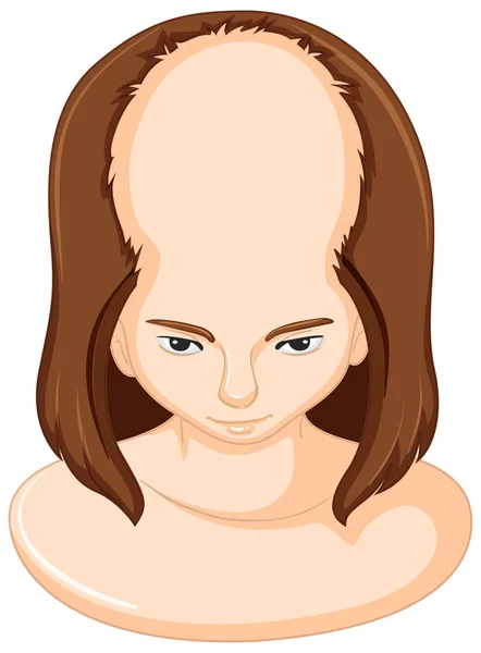 Fille perdre beaucoup de cheveux — Image vectorielle