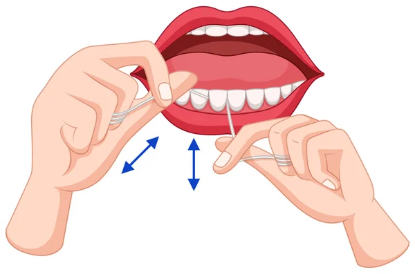 Proceso de dientes de hilo dental — Archivo Imágenes Vectoriales