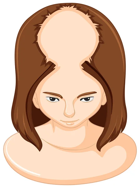 Femme perdant beaucoup de cheveux — Image vectorielle