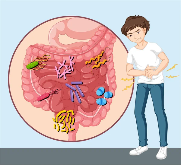 Man having food poisoning — Stock Vector