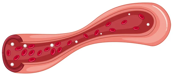 Diagrama de primer plano del coágulo sanguíneo — Vector de stock