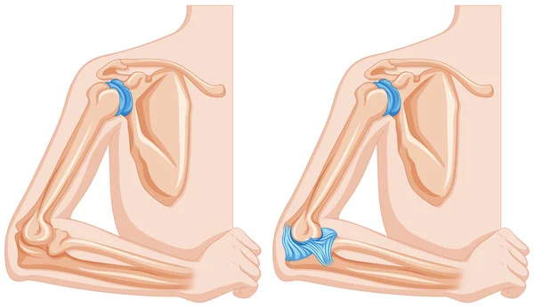 Diagram som visar armbåge lederna — Stock vektor