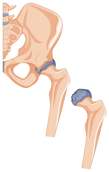 Close up picture of hip bones — Stock Vector