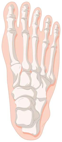 Bone x-ray for gout toe — Stock Vector