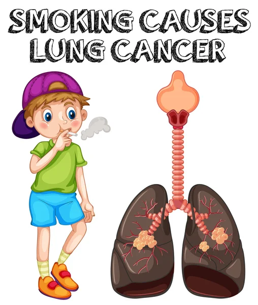 Pojke röker cigarett och lungcancer — Stock vektor
