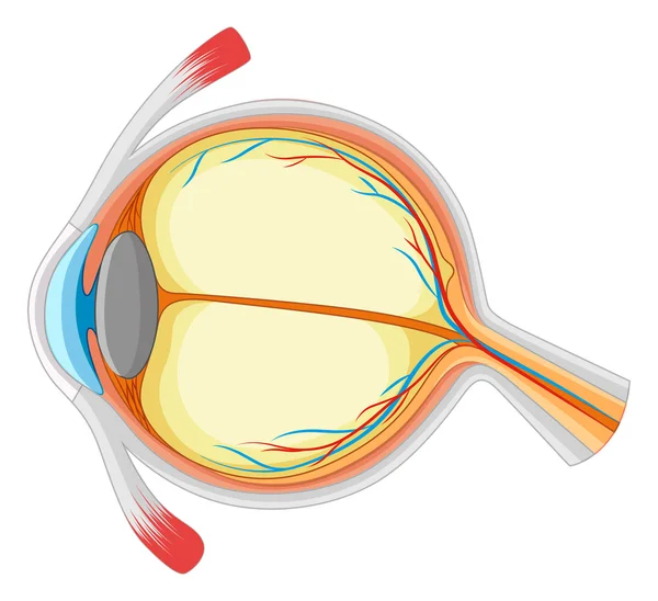 Ojo humano con enfermedad — Vector de stock