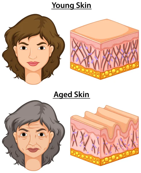 Vrouw met jonge en oude huid — Stockvector
