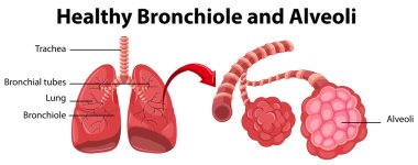 Sağlıklı bronchiole ve alveoller gösteren diyagram