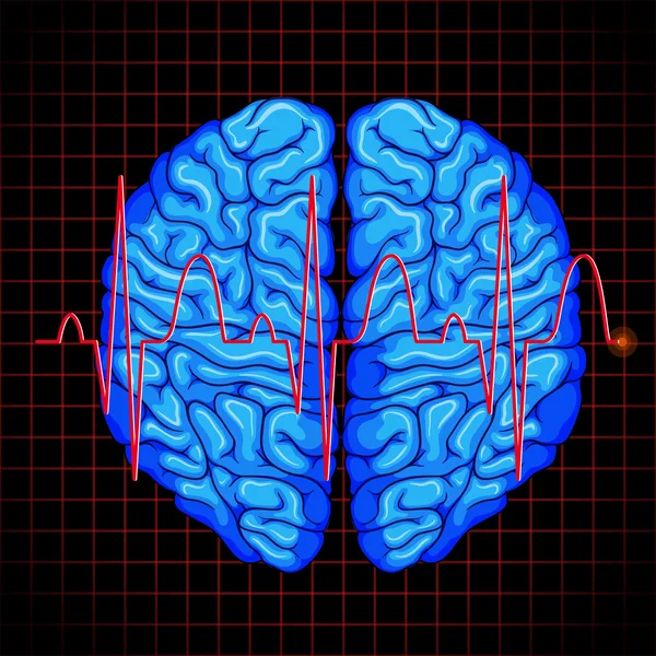 Graphique cerveau humain et cerveau sur les grilles — Image vectorielle