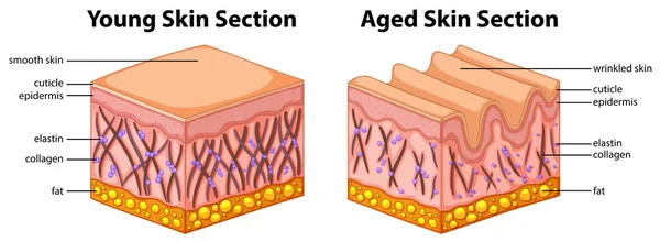 Diagram ukazující mladé a staré kůže — Stockový vektor