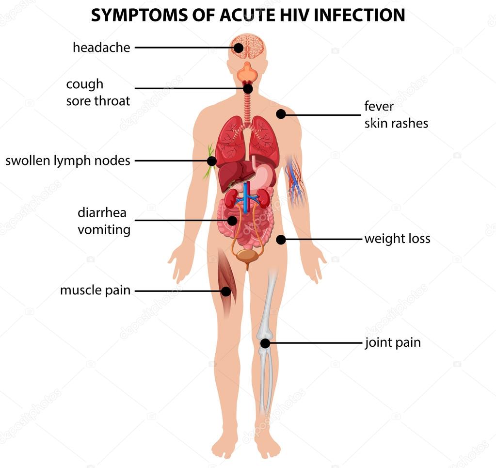 sintomi infezione hiv sintomi infezione hiv