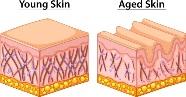 Diagram som visar unga och äldre hud — Stock vektor