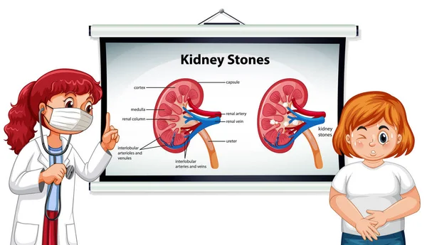 Ledvinové Kameny Příznaky Karikatura Styl Infographic Lékařem Kreslený Charakter Ilustrace — Stockový vektor