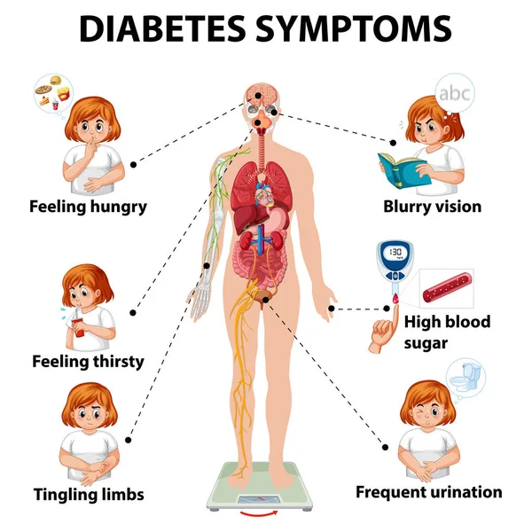 Diabetes Symptomy Informace Infografické Ilustrace — Stockový vektor