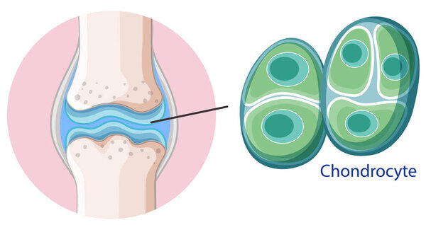 Информационный плакат иллюстрации хондроцитов