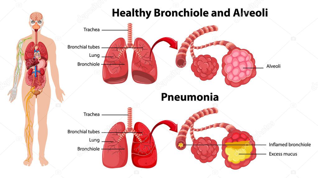 Healthy and unhealthy of human lungs illustration