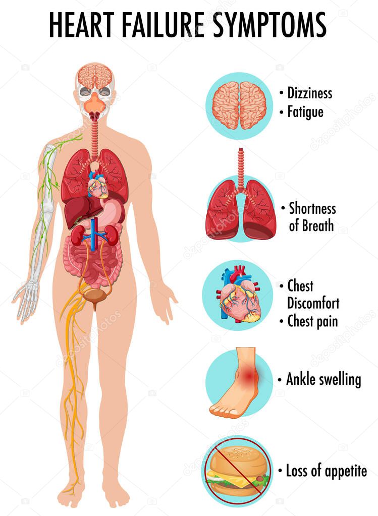 Heart failure symptoms information infographic illustration