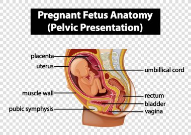 Hamile Fetüs Anatomisi (Pelvik Sunum)