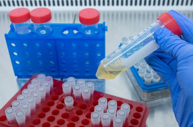 Bilim adamı elinde, küçük test tüpleriyle rafların arkasında sarı bir sıvı numunesiyle büyük bir test tüpü tutuyor. Biyolojik sıvılar ve çözümler.