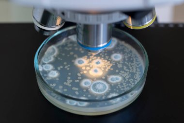 Petri kabındaki bakteriler mikroskop altında inceleniyor. Mikroskop altında bakteri araştırması.