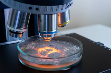 Mikroskop hedeflerinin büyültülmesi altında bir petri kabındaki bakteriler, yakın çekim. Kırmızı ışığı olan bakteri kolonilerine odaklan.
