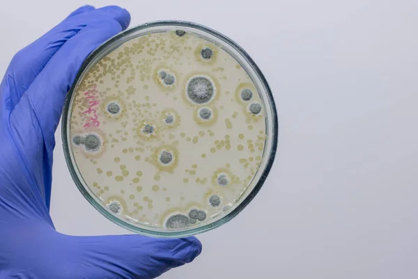 A petri dish with bacteria colonies and mold on a solid background, close-up in the hand of a scientist.