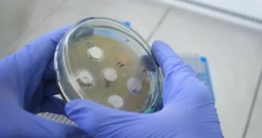 Yakın planda, bir bilim adamı besleyici agar ile büyümüş bir petri kabındaki bakterileri inceliyor. Deneyin sonuçlarının incelenmesi.