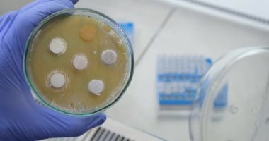 Bir bilim adamı bir petri kabını açar ve bir petri kabında bakterilerin büyümesini gözlemler, raflarda deney tüpleri bulunan bir laboratuvar masasının arka planına karşı.