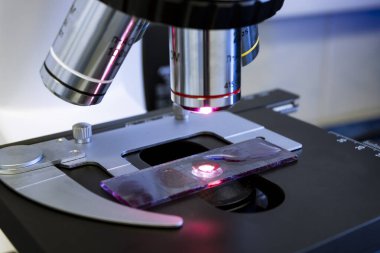 Mikroskop altında, mikroskop hedeflerine yakın çekim olarak, üzerinde örnek bulunan bir slayt mikroskoba yerleştirilir. Mikroskop altında bakteri araştırması.