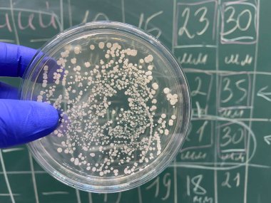 Bir bilim adamının elinde küçük bakteri kolonileri olan bir petri kabı tebeşirle yazılmış sayılarla dolu yeşil bir tahtaya karşı..