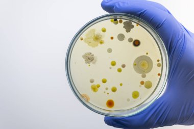 Yakın plan, bir bilim adamı elinde farklı renkli bakteri kolonileri olan bir petri kabı, havadan izolasyon, saflık testi.