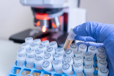 Bir bilim adamı, laboratuvar kutusundaki bir dizi aşıdan açık sarı bir sıvıyla kapalı bir test tüpünü kırmızı ışıkta mikroskobun arka planına doğru çekiyor..