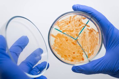 Bilim adamı büyük miktarda turuncu renkli bakteriyi incelemek için bir petri kabının kapağını açtı. Mikroorganizmalarla dolu bir bardağı tutan bir bilim adamının yakın çekimi..