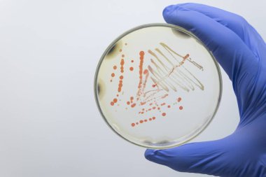 Bilim adamı, eldivenli elleriyle turuncu ve sarı bakterilerden oluşan patojenik kolonilerle dolu bir Petri kabı tutuyor. İnsanlardan bakteri izolasyonu.