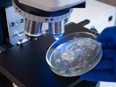 Bilim adamı mikroskop altında bakteri kolonileri olan açık bir petri kabı tutuyor. Mikroskop altında küçük mikroplarda artış.