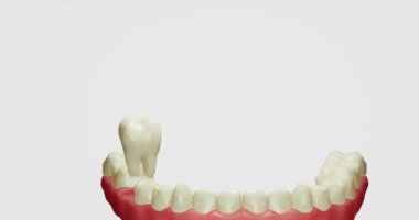 Üç boyutlu animasyon ayrılığı, tarama, tedavi, azı dişinin röntgeni. Diş alt çeneden yükselir, mavi oklar azı dişinin etrafında uçar, dişin üzerinde çokgen bir ızgara belirir