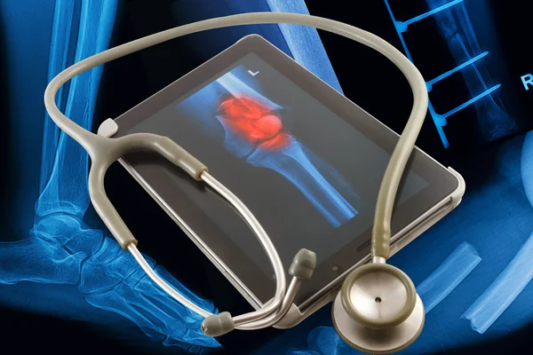 Tablette médicale moderne sur fond d'images radiographiques — Photo