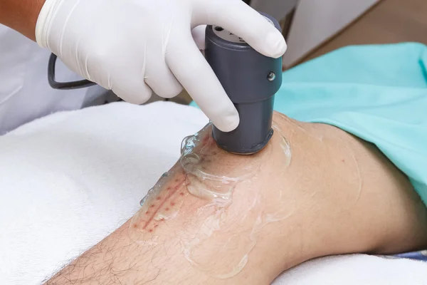 Fisioterapeuta está aplicando terapia de ultrasonido en la rodilla —  Fotos de Stock