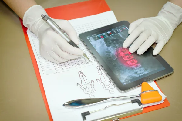 Médico viendo la radiografía del paciente para hacer un diagnóstico en la mesa — Foto de Stock